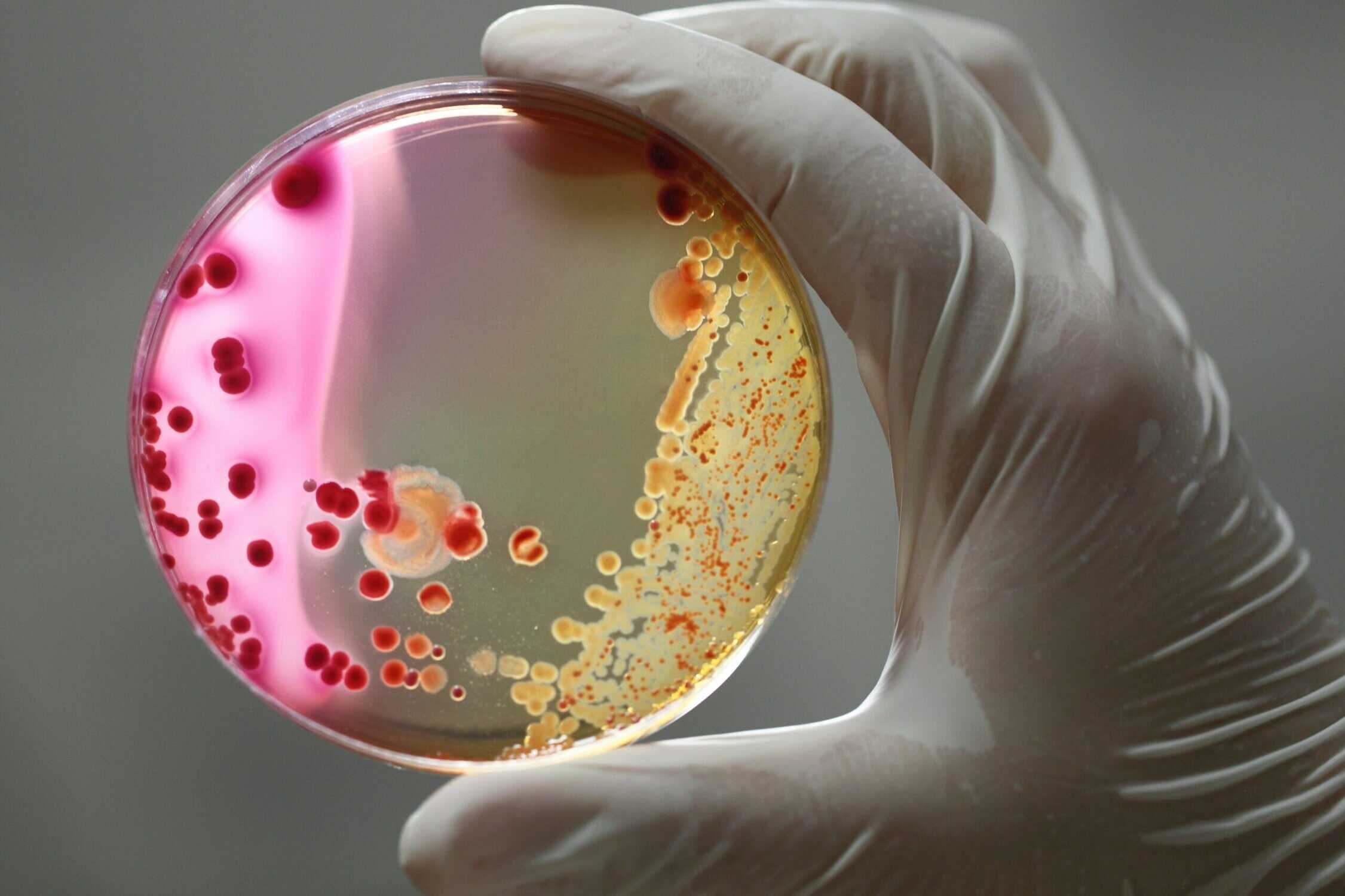 Scientist looking at pink and yellow chemicals while wearing a white glove