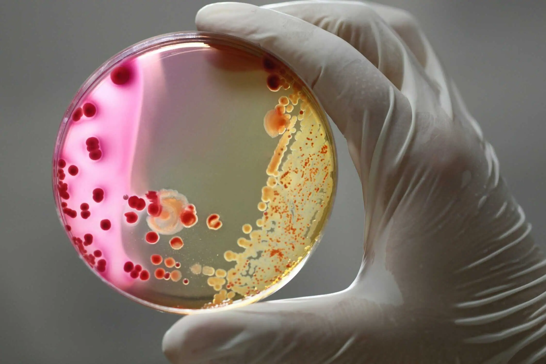 Scientist looking at pink and yellow chemicals while wearing a white glove