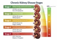 Colorful chart on kidney disease stages with pictures of kidney down the right side